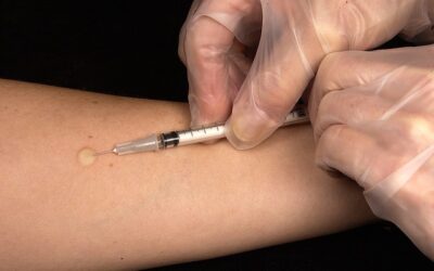OMT: ‘Ongevaccineerde broer of zus van kind met mazelen mag niet naar de kinderopvang’